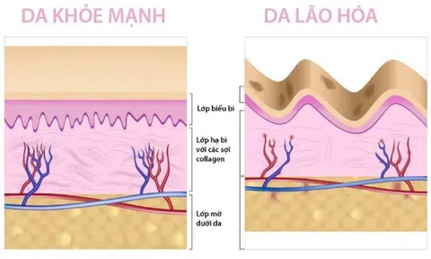 Biện pháp dễ thực hiện giúp làm chậm lão hóa da