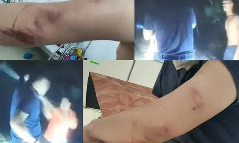 Điều tra vụ phóng viên bị tấn công dã man khi đang tác nghiệp