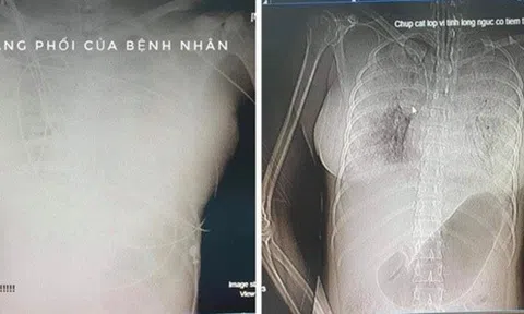 Vụ nghi án cô gái 30 tuổi tử vong sau khi nâng ngực: Vì sao bác sĩ chi 20 triệu nhờ trại hòm khâm liệm?