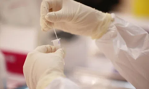 Hà Nội hỗ trợ 100% chi phí xét nghiệm sàng lọc COVID-19