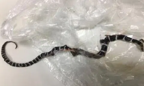 Cháu bé 5 tuổi bị rắn cạp nia cắn, người thân đập chết rắn rồi mang cùng vào viện