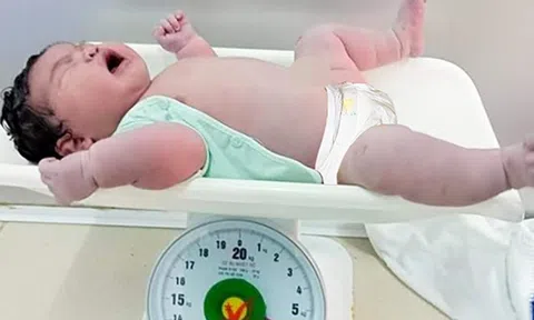 Bé gái sơ sinh chào đời với cân nặng 6,2kg