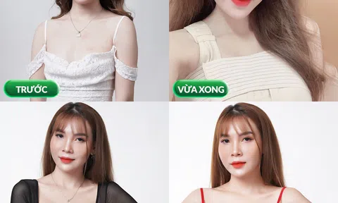 Công nghệ làm đẹp 2 trong 1 hot nhất hiện nay: “Tút” lại vòng 2, tăng size vòng 1