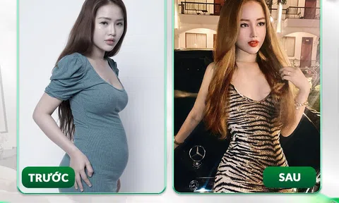 Phẫu thuật thẩm mỹ sẽ thay đổi con người bạn như thế nào?