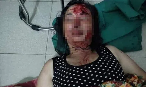 Công an Hải Dương vào cuộc vụ vợ tố chồng chích điện, dìm xuống ao lúc nửa đêm