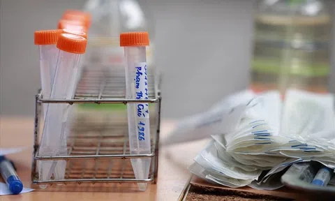 Lấy gần 1,3 triệu mẫu xét nghiệm diện rộng, phát hiện 18 mẫu dương tính Covid-19