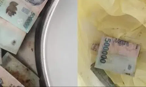 Hy hữu người phụ nữ phải cấp cứu vì nuốt 12,5 triệu đồng tiền polyme vào bụng