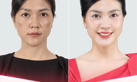 Hành trình 15 năm khẳng định vị thế & uy tín hàng đầu cả nước của Thẩm mỹ viện Thiên Hà