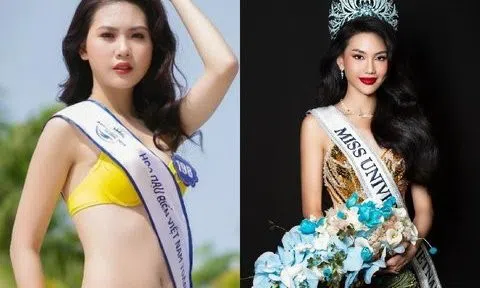 Chuyên gia nội khoa nghi ngờ Bùi Quỳnh Hoa căng chỉ mắt, tiêm filler để thi hoa hậu