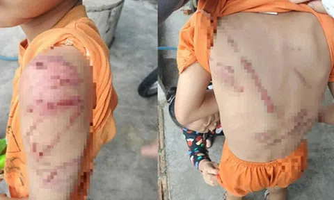 Phẫn nộ hình ảnh bé trai 10 tuổi bị cha ruột đánh đập lan truyền mạng xã hội