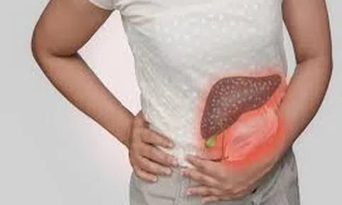 Đau bụng sau khi ăn buffet, cô gái 30 tuổi tử vong chỉ sau 48 giờ, bác sĩ cảnh báo bệnh diễn tiến cực nhanh