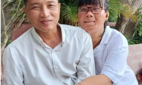 Cứu con của bạn trai khỏi biển lửa, người phụ nữ bị bỏng 78% cơ thể, giờ ra sao?
