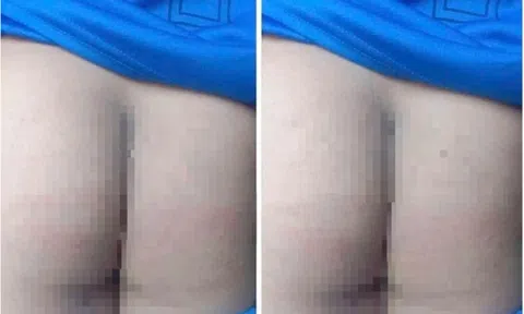 Vụ phụ huynh vào trường đánh học sinh 10 roi theo "giao kèo": Cà Mau chỉ đạo làm rõ