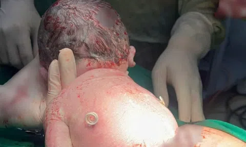 Em bé sống sót nhờ “đôi cánh” đặc biệt trên lưng từ trong bụng mẹ