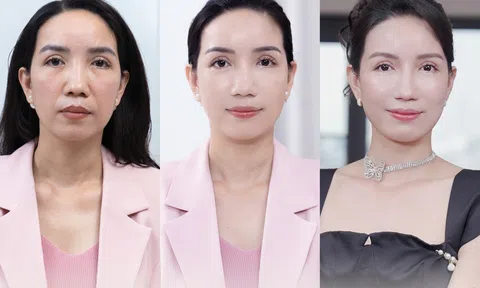 Bich Nguyet Beauty Medical - Địa chỉ dẫn đầu trẻ hóa tại miền Bắc với công nghệ PicoGen AI