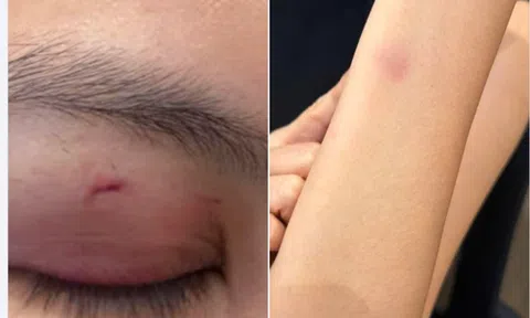 Công an xác minh vụ ca sĩ Trung Quân Idol bị tố hành hung nữ bác sĩ