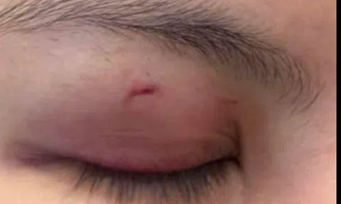 Trung Quân Idol xin lỗi công khai sau ồn ào bị tố hành hung nữ bác sĩ