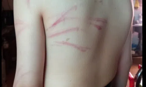 Đồng Tháp: Làm rõ vụ giáo viên dạy thêm dùng cành cây đánh học sinh