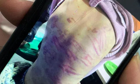 Vụ bé gái ở Hà Nội bị người tình của mẹ xâm hại: Yêu râu xanh xâm hại 9 lần