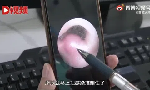 Bé trai 8 tuổi suýt mất mạng vì nhiễm trùng não, bác sĩ cảnh báo dừng ngay thói quen nhiều người mắc phải
