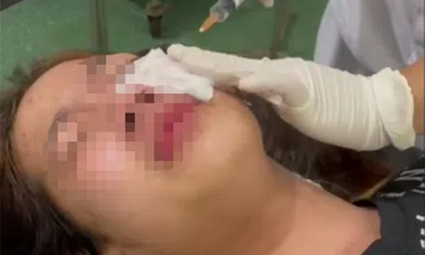 Vụ nữ sinh 15 tuổi ở Hải Phòng bị đánh, bắt quỳ xin lỗi, xịt hơi cay: Bàng hoàng lời kể của nạn nhân