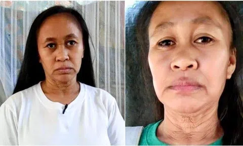 Thiếu nữ 16 tuổi bỗng biến thành bà lão chỉ trong vòng 2 năm