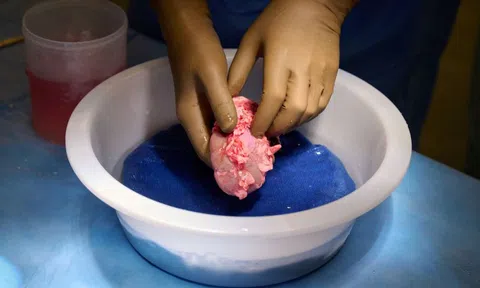 Lần đầu tiên ghép thành công thận heo cho người
