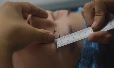 Vợ nghe lời đường mật đi thẩm mỹ để “đổi phong thủy cho chồng”, ngờ đâu phải trả cái giá quá đắt