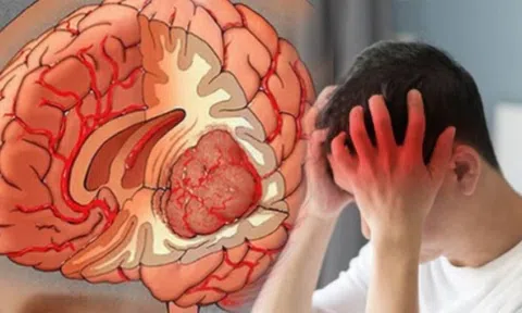 Nếu thấy 7 dấu hiệu này vào buổi sáng, cần đi khám ngay kẻo hối hận