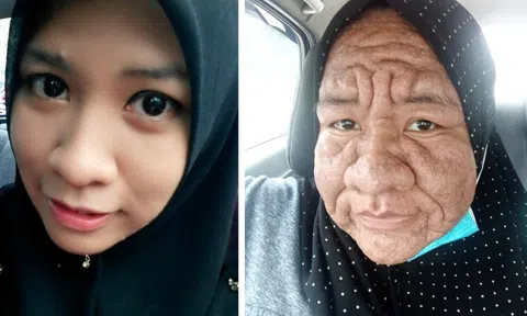 Người phụ nữ 28 tuổi bỗng hóa bà lão chỉ sau 1 đêm, nguyên nhân gây ngỡ ngàng