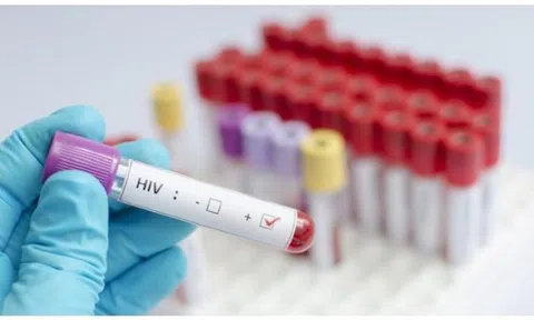 Phát hiện người phụ nữ tự khỏi HIV, không cần dùng thuốc