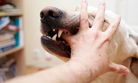 Bé 5 tuổi tử vong sau 1 tháng bị chó cắn, gia đình đắp ớt bột vào vết thương