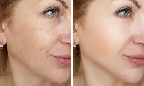5 lợi ích làn da nhận được khi tắm bằng nước lạnh