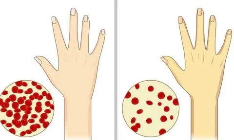 Mỗi ngày ăn 1 quả ớt chuông, cơ thể sẽ nhận về 6 lợi ích bất ngờ