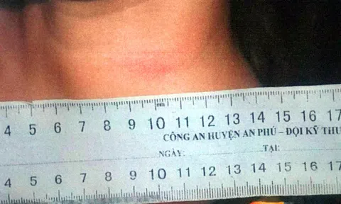 Sự thật sau lá đơn trình báo bị cướp tiền, vàng của cô gái trẻ