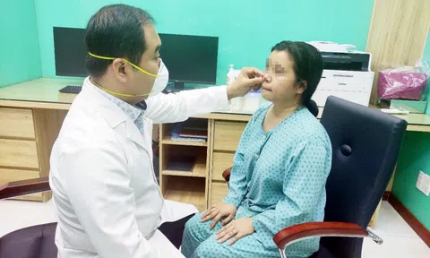 Mất tiền nâng mũi, 4 năm sau đau đớn nhận cái kết "đắng"