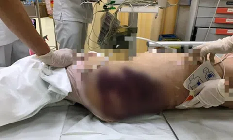 Vụ bé gái 8 tuổi nghi bị "dì ghẻ" đánh tới chết: Ám ảnh cây lau nhà đã gãy, dính tóc của nạn nhân