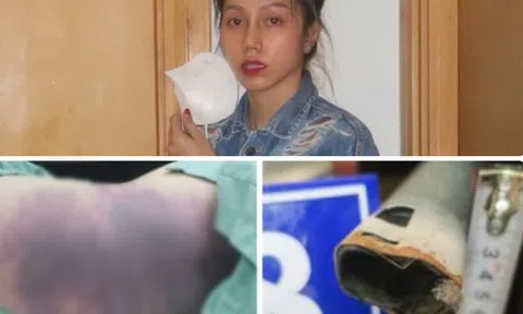 Vụ bé gái 8 tuổi bị bạo hành ở TP.HCM: Khởi tố bổ sung tội Giết người đối với "dì ghẻ"