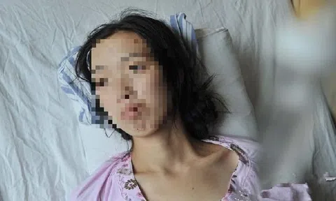 Cô gái chưa từng hút thuốc, uống rượu nhưng qua đời vì ung thư, bác sĩ lập tức kể 3 thói quen