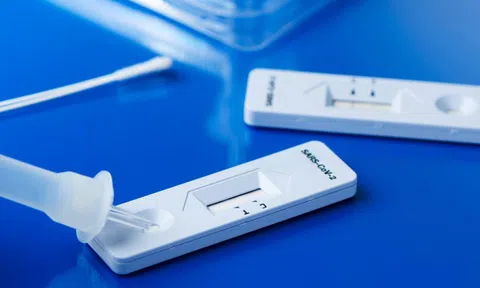 Cần làm gì để hạn chế “dương tính giả” khi test nhanh COVID-19?