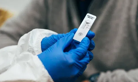 Có nên test nhanh COVID-19 ngay sau khi tiếp xúc với F0?