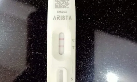 Các chuyên gia lý giải việc vạch kit test Covid-19 lúc mờ lúc đậm