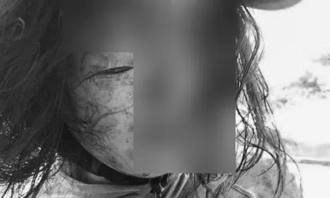 Đi làm giấy tờ ly hôn, người phụ nữ bất ngờ bị tấn công, rạch mặt