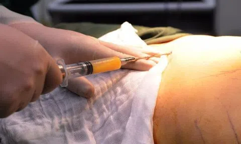 Vụ cô gái tử vong sau khi hút mỡ: 3 người bị bắt giam