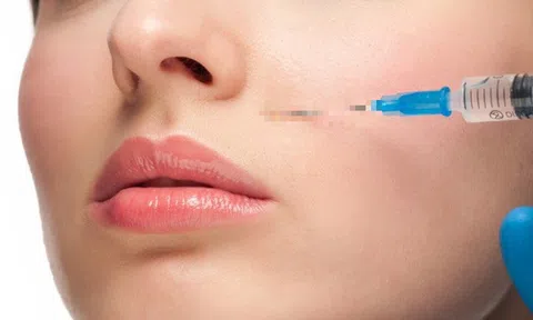 Người phụ nữ 27 tuổi mất thị lực sau tiêm filler làm đầy rãnh má ở tiệm tóc