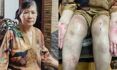 Người phụ nữ sống sót sau 7 ngày rơi xuống vực: Không bịa chuyện để "câu like"