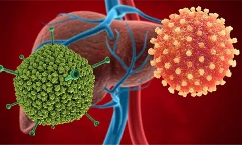 Bộ Y tế yêu cầu giám sát bệnh viêm gan cấp tính “bí ẩn” ở trẻ em