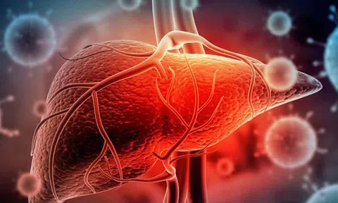 Chuyên gia nhận định về khả năng viêm gan "bí ẩn" vào Việt Nam