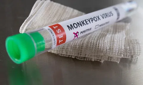 Bộ y tế yêu cầu tăng cường giám sát, phòng chống bệnh đậu mùa khỉ