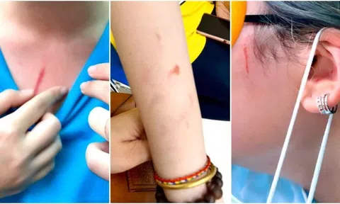 Bộ GD&ĐT chỉ đạo xử lý vụ học sinh bị bạo lực ở trường quốc tế TP. HCM